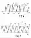 Fig. 03 - System for reinforcing a building structural component