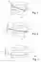 Fig. 02 - System and method for treating a patient with obstructive sleep apnea
