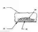 Fig. 01 - Emergency transport back support apparatus and method