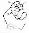 Fig. 01 - RING FOR RELIEVING THE URGE TO SMOKE