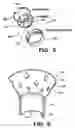 Fig. 04 - Fuel nozzle support funnel