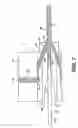 Fig. 05 - Method of manufacturing a guidewire with an extrusion jacket