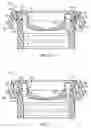 Fig. 09 - Valve carrier ring assembly