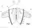 Fig. 04 - BACKPACK OR OTHER WEARABLE OBJECT WITH DEPLOYABLE APPENDAGES