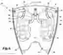 Fig. 07 - BACKPACK OR OTHER WEARABLE OBJECT WITH DEPLOYABLE APPENDAGES