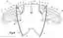 Fig. 09 - BACKPACK OR OTHER WEARABLE OBJECT WITH DEPLOYABLE APPENDAGES