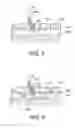 Fig. 04 - Low-profile vascular closure systems and methods of using same