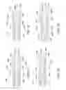 Fig. 16 - Low-profile vascular closure systems and methods of using same