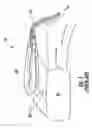 Fig. 02 - HIGH LIFT DISTRIBUTED ACTIVE FLOW CONTROL SYSTEM AND METHOD
