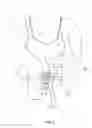 Fig. 04 - Method and apparatus for support of a medical device
