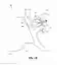 Fig. 03 - SHOOTING GALLERY DEVICES AND METHODS