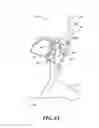 Fig. 09 - SHOOTING GALLERY DEVICES AND METHODS