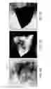 Fig. 07 - Systems and methods of all-optical Fourier phase contrast imaging using dye doped liquid crystals