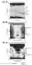 Fig. 08 - Time reverse reservoir localization