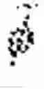 Fig. 07 - Magnetic resonance imaging by subspace projection