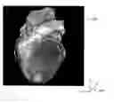 Fig. 01 - Method and a system for registering a 3D pre acquired image coordinates system with a medical positioning system coordinate system and with a 2D image coordinate system