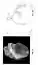 Fig. 02 - Method and a system for registering a 3D pre acquired image coordinates system with a medical positioning system coordinate system and with a 2D image coordinate system