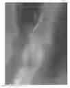 Fig. 01 - Computer program products and methods for detection and tracking of rheumatoid arthritis