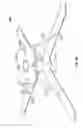 Fig. 14 - Foundation lifting assembly and method of use