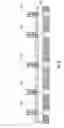 Fig. 16 - Foundation lifting assembly and method of use