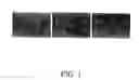 Fig. 02 - METHOD FOR INDUCING NEURAL DIFFERENTIATION