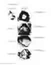 Fig. 09 - Methods of treating neovascular glaucoma, macular degeneration and capillary proliferation with alphavbeta3-specific antibodies