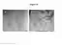 Fig. 09 - Self-assembling peptide amphiphiles