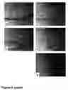 Fig. 07 - Methods of treating neurological conditions with hematopoeitic growth factors