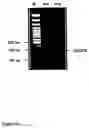 Fig. 16 - Methods of treating neurological conditions with hematopoeitic growth factors