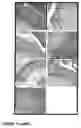 Fig. 23 - Methods of treating neurological conditions with hematopoeitic growth factors