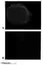 Fig. 27 - Methods of treating neurological conditions with hematopoeitic growth factors