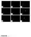 Fig. 31 - Methods of treating neurological conditions with hematopoeitic growth factors