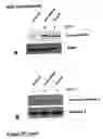 Fig. 32 - Methods of treating neurological conditions with hematopoeitic growth factors