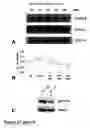 Fig. 35 - Methods of treating neurological conditions with hematopoeitic growth factors