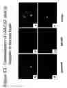 Fig. 71 - Methods of treating neurological conditions with hematopoeitic growth factors