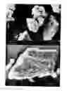 Fig. 17 - Particulate comprising a calcium-containing compound and a sugar alcohol