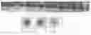 Fig. 01 - Composite material constituted by a porous matrix and nanoparticles of metal or metal oxide