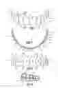 Fig. 02 - Demonstration dental template and matching temporary overlay