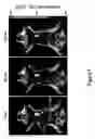 Fig. 07 - MEMBRANE BOUND REPORTER GENE SYSTEM