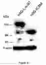 Fig. 22 - MEMBRANE BOUND REPORTER GENE SYSTEM