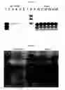 Fig. 04 - Method for detecting PrP using at least one positive charge and/or at least one glycosidic bond and a ligand other than a protein ligand