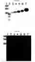 Fig. 06 - Method for detecting PrP using at least one positive charge and/or at least one glycosidic bond and a ligand other than a protein ligand