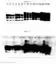 Fig. 07 - Method for detecting PrP using at least one positive charge and/or at least one glycosidic bond and a ligand other than a protein ligand