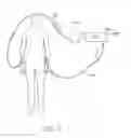 Fig. 46 - Sensors for detecting substances indicative of stroke, ischemia, infection or inflammation