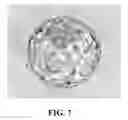 Fig. 06 - In vitro maturation of immature human oocytes