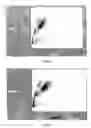 Fig. 04 - Lytic reagent and method for leukocytes differential in whole blood