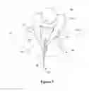 Fig. 07 - Wearable golf swing training aid and method of using the same
