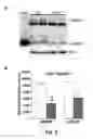 Fig. 07 - UPREGULATING ACTIVITY OR EXPRESSION OF BDNF TO MITIGATE COGNITIVE IMPAIRMENT IN ASYMPTOMATIC HUNTINGTON'S SUBJECTS