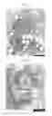 Fig. 02 - METHOD OF PREVENTING OR TREATING METABOLIC SYNDROME