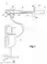 Fig. 02 - ENDOSCOPE WITH DILATING INSERTION TUBE